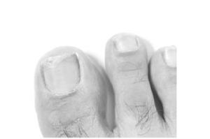 TERBINAFIN-1A Pharma Nagell.g.Nagelpilz 78.22mg/ml, 6,6 ml
