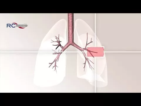 Video o produktu RC Cornet Plus, 1 ks
