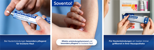 SOVENTOL Hydrocort 0,5% krém, 30 g