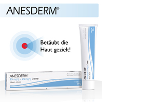 ANESDERM 25 mg/g + 25 mg/g krému + 10 náplastí, 5x5 g