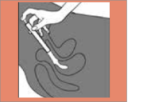 CLOTRIMAZOL AL 2% vaginální krém, 20 g