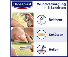 HANSAPLAST Elastická omítka 6 cmx1 m, 1 ks