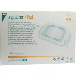 TEGADERM 3M Plus Pad 9x10 cm Ready Made.3586, 25 ks