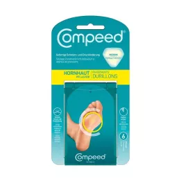 COMPEED Sádra na kalusy, 6 ks