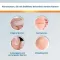 EndWarts® CLASSIC roztok, 3 ml