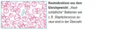Instructions for use for AKTIVADERM ND Aktivní probiotika pro léčbu neurodermatitidy, 125 g - 2